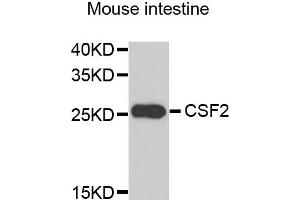 Western blot analysis of extracts of mouse intestine, using CSF2 antibody. (GM-CSF antibody)