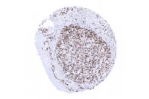 tonsil surface epithelium (Ki-67 antibody  (AA 2293-2478))