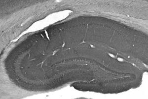 Adult rat hippocampus immunohistochemistry. (CNTNAP2 antibody  (Extracellular))