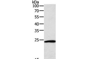 Western Blot analysis of Hela cell using SNAP25 Polyclonal Antibody at dilution of 1:400 (SNAP25 antibody)