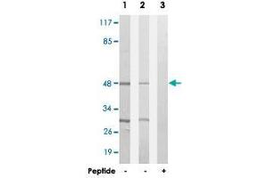 Western blot analysis of extracts from HepG2 cells (Lane 1 and lane 3) and HUVEC cells (Lane 2), using SLC16A14 polyclonal antibody .