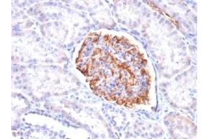 Immunohistochemical staining (Formalin-fixed paraffin-embedded sections) of human kidney with WT1 recombinant monoclonal antibody, clone rWT1/857 . (Recombinant WT1 antibody)