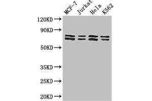 Western Blot Positive WB detected in: MCF-7 whole cell lysate, Jurkat whole cell lysate, Hela whole cell lysate, K562 whole cell lysate All lanes: TRIM25 antibody at 3 μg/mL Secondary Goat polyclonal to rabbit IgG at 1/50000 dilution Predicted band size: 71 kDa Observed band size: 71, 80 kDa (TRIM25 antibody  (AA 81-272))