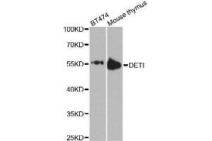 Western blot analysis of extracts of various cell lines, using DET1 antibody. (DET1 antibody  (AA 15-240))