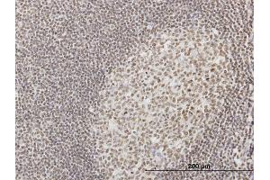 Immunoperoxidase of monoclonal antibody to IFI16 on formalin-fixed paraffin-embedded human tonsil. (IFI16 antibody  (AA 630-729))