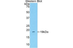 Western blot analysis of the recombinant protein. (Mannose Associated Serine Protease 2 (AA 280-433) antibody)