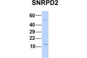 Host:  Rabbit  Target Name:  SNRPD2  Sample Type:  Human 293T  Antibody Dilution:  1. (SNRPD2 antibody  (N-Term))