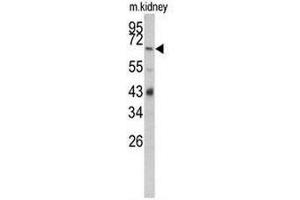 Western blot analysis of CFB Antibody (Center) in mouse kidney tissue lysates (35µg/lane). (Complement Factor B antibody  (Middle Region))