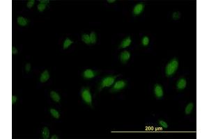Image no. 3 for anti-RNA Guanine-7 Methyltransferase (RNMT) (AA 1-477) antibody (ABIN599057) (RNMT antibody  (AA 1-477))
