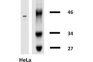 Western blotting analysis of human cytokeratin 18 using mouse monoclonal antibody DA-7 on lysates of HT-29 cell line and MOLT-4 cell line (cytokeratin non-expressing cell line, negative control) under non-reducing and reducing conditions. (Cytokeratin 18 antibody  (Biotin))