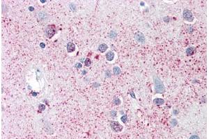 Anti-SRPX2 antibody  ABIN960820 IHC staining of human brain, cortex. (SRPX2 antibody  (C-Term))