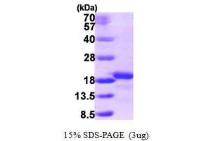 SDS-PAGE (SDS) image for Ionized Calcium-binding Adapter Molecule 2 (IBA2) (AA 1-150) protein (His tag) (ABIN667330) (AIF1L Protein (AA 1-150) (His tag))