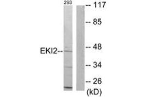 Western blot analysis of extracts from 293 cells, using EKI2 Antibody. (Ethanolamine Kinase 2 antibody  (AA 51-100))