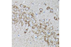 Immunohistochemistry of paraffin-embedded rat brain using SNAPIN Rabbit pAb  at dilution of 1:200 (40x lens). (SNAPIN antibody  (AA 1-136))
