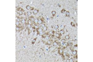 Immunohistochemistry of paraffin-embedded rat brain using SNAPIN Rabbit pAb  at dilution of 1:200 (40x lens). (SNAPIN antibody  (AA 1-136))