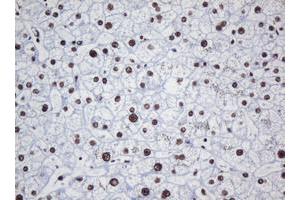 Image no. 2 for anti-Decapping Enzyme, Scavenger (DCPS) antibody (ABIN1497780)
