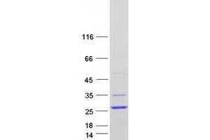 Western Blotting (WB) image for Nescient Helix Loop Helix 2 (NHLH2) (Transcript Variant 2) protein (Myc-DYKDDDDK Tag) (ABIN2722617)