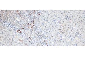 Immunohistochemistry of paraffin-embedded Rat ovary using Phospho-MYL9(T18/S19) Polyclonal Antibody at dilution of 1:100 (20x lens). (MYL9 antibody  (pSer19, pThr18))
