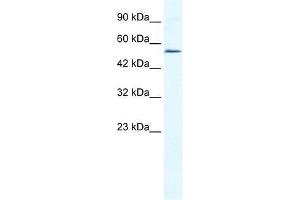Western Blot showing ZNF286 antibody used at a concentration of 1-2 ug/ml to detect its target protein. (ZNF286A antibody  (N-Term))