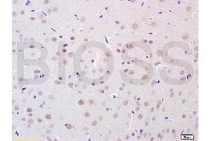Formalin-fixed and paraffin embedded rat brain tissue labeled with Anti-BRN3A Polyclonal Antibody, Unconjugated (ABIN702400) at 1:100 followed by conjugation to the secondary antibody, (SP-0023), and DAB staining