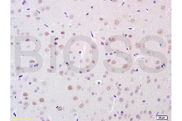POU4F1 anticorps  (AA 325-419)