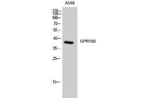 Western Blotting (WB) image for anti-Relaxin/insulin-Like Family Peptide Receptor 4 (RXFP4) (C-Term) antibody (ABIN3184827) (RXFP4 antibody  (C-Term))