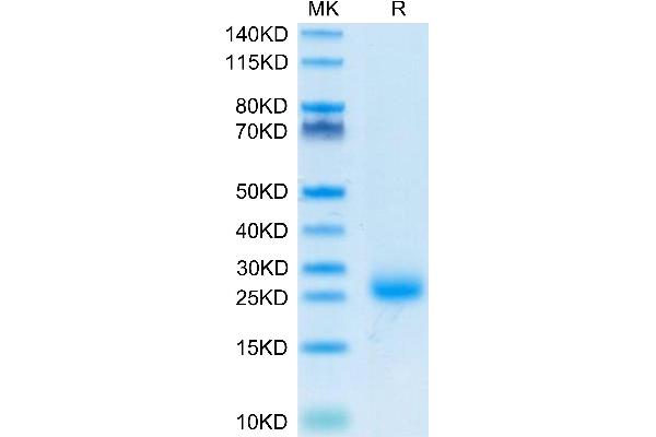 IL-31 Protein (AA 27-163) (His tag)