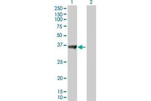 Western Blot analysis of SNX11 expression in transfected 293T cell line by SNX11 MaxPab polyclonal antibody. (SNX11 antibody  (AA 1-270))