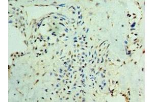 Immunohistochemistry (IHC) image for anti-SMAD, Mothers Against DPP Homolog 3 (SMAD3) (AA 1-230) antibody (ABIN7160232)