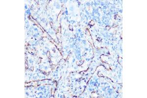 Immunohistochemistry (IHC) image for anti-Caveolin 1, Caveolae Protein, 22kDa (CAV1) (AA 1-100) antibody (ABIN6137992)