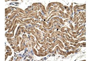 ATP5B antibody was used for immunohistochemistry at a concentration of 4-8 ug/ml to stain Skeletal muscle cells (arrows) in Human Muscle. (ATP5B antibody  (N-Term))