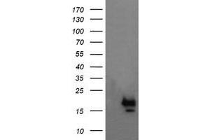 Image no. 1 for anti-NFKB Inhibitor Interacting Ras-Like 1 (NKIRAS1) antibody (ABIN1499743) (NKIRAS1 antibody)