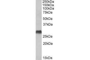 ABIN571247 (1µg/ml) staining of Human Bone Marrow lysate (35µg protein in RIPA buffer). (HLA-DQA2 antibody  (C-Term))