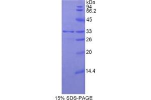 SDS-PAGE analysis of Rat MYH11 Protein. (MYH11 Protein)