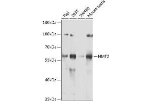 Western blot analysis of extracts of various cell lines, using NMT2 antibody (ABIN6130572, ABIN6144688, ABIN6144690 and ABIN6222825) at 1:1000 dilution. (NMT2 antibody  (AA 1-120))