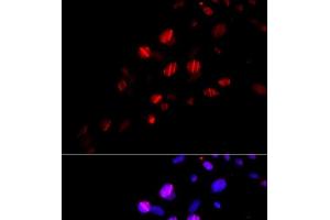 Immunofluorescence analysis of U2OS cells using RAD18 Polyclonal Antibody (RAD18 antibody)