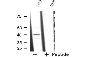 Western blot analysis of extracts from LOVO cells, using RAD23A antibody. (RAD23A antibody  (C-Term))