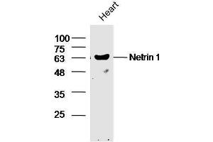 Mouse heart lysates probed with Rabbit Anti-Netrin 1 Polyclonal Antibody, Unconjugated  at 1:5000 for 90 min at 37˚C. (Netrin 1 antibody  (AA 501-604))