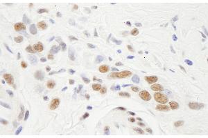 Immunohistochemistry (IHC) image for anti-Nuclear Transcription Factor Y, alpha (NFYA) (AA 333-347) antibody (ABIN7448690) (NFYA antibody  (AA 333-347))