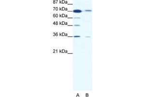 Western Blotting (WB) image for anti-SMAD Family Member 4 (SMAD4) antibody (ABIN2460350) (SMAD4 antibody)