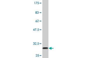 Western Blot detection against Immunogen (30. (Thymosin beta 10 antibody  (AA 1-44))