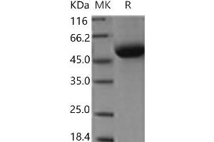 Western Blotting (WB) image for Discoidin Domain Receptor tyrosine Kinase 1 (DDR1) protein (His tag) (ABIN7321078) (DDR1 Protein (His tag))