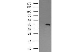 Image no. 1 for anti-Mitogen-Activated Protein Kinase 13 (MAPK13) antibody (ABIN1499961) (MAPK13 antibody)
