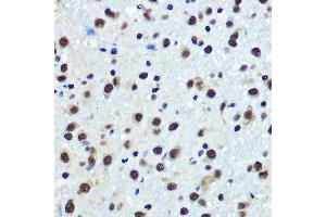 Immunohistochemistry of paraffin-embedded rat brain using hnRNP K Rabbit mAb (ABIN7267634) at dilution of 1:100 (40x lens). (HNRNPK antibody)