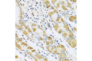 Immunohistochemistry of paraffin-embedded human stomach using PSG1 antibody at dilution of 1:100 (40x lens).