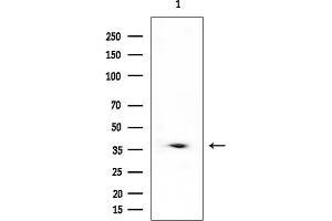 anti-G Patch Domain and Ankyrin Repeats 1 (GPANK1) antibody
