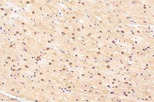 Immunohistochemistry analysis of paraffin-embedded mouse heart using,NOS1AP (ABIN7074844) at dilution of 1: 4000 (NOS1AP antibody)