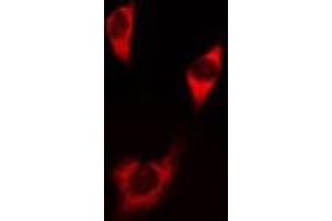 ABIN6275828 staining NIH-3T3 cells by IF/ICC. (PIK3 gamma antibody  (C-Term))