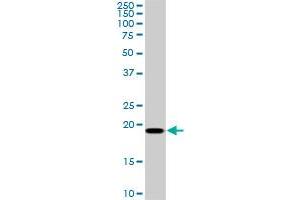 SRI monoclonal antibody (M01), clone 1E12. (SRI antibody  (AA 1-198))