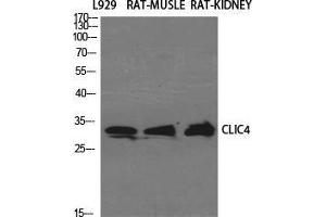 Western Blot (WB) analysis of specific cells using CLIC4 Polyclonal Antibody. (CLIC4 antibody  (N-Term))